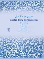 Guided Bone Regeneration سیری در 30 سال