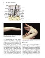 Local Flaps in Facial Reconstruction 4e 2022 - Image 3