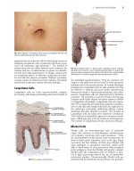 Local Flaps in Facial Reconstruction 4e 2022 - Image 4