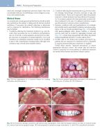 Contemporary Fixed Prosthodontics Rosenstiel 2023  (SIXTH EDITION) - Image 10