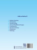 DBQ (مجموعه سوالات بورد دندانپزشکی) پروتزهای دندانی - Image 3