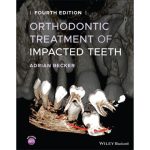 Frame 6 Orthodontic Treatment of Impacted Teeth 4e 2022 - Image 2