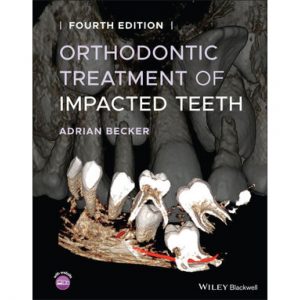 Orthodontic Treatment of Impacted Teeth 4e 2022
