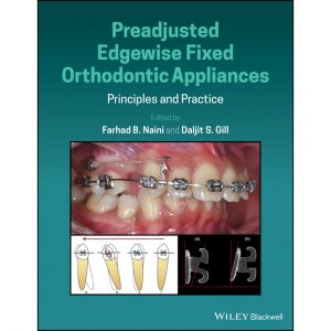 Preadjusted Edgewise Fixed Orthodontic Appliances 2022