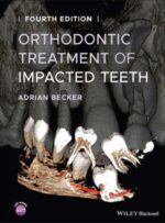 Orthodontic Treatment of Impacted Teeth 4e 2022