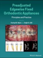 Preadjusted Edgewise Fixed Orthodontic Appliances 2022