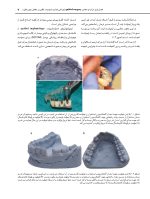 جراحی هدایت شونده نهایی_Page_7 جراحی هدایت شونده در ایمپلنتولوژی - Image 5