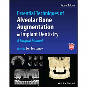 Essential Techniques of Alveolar Bone Augmentation in Implant Dentistry: A Surgical Manual 2e 2023