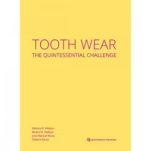 Tooth Wear: The Quintessential Challenge 2023