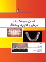 اصول و بیومکانیک درمان با الاینرهای شفاف