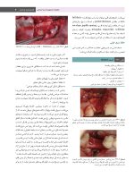 ترجمه میش جلد سوم - Copy_Page_07 ایمپلنت دندانی میش 2021 جلد سوم - Image 7