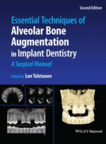 Essential Techniques of Alveolar Bone Augmentation in Implant Dentistry: A Surgical Manual (Second Edition) 2023