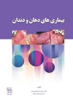 بیماری های دهان و دندان