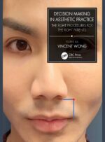 Decision Making in Aesthetic Practice: The Right Procedures for the Right Patients 2022