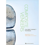 Frame 8 (2) Composite Veneers: The Direct-Indirect Technique 2020 - Image 1