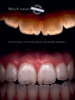 Biomimetic Restorative Dentistry 2022 - Image 5