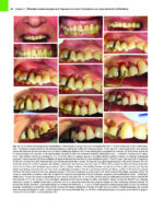 Principles and Practice of Laser Dentistry (Third Edition) 2023 - Image 5