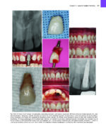Principles and Practice of Laser Dentistry (Third Edition) 2023 - Image 7