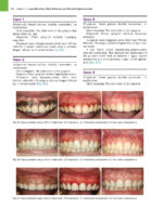 Principles and Practice of Laser Dentistry (Third Edition) 2023 - Image 8