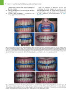 Principles and Practice of Laser Dentistry (Third Edition) 2023 - Image 9