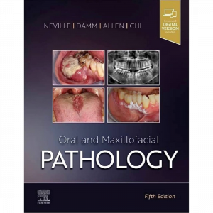 Oral and Maxillofacial Pathology(NEVILLE) 2023