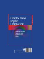 عوارض پیچیده ی ایمپلنت های دندانی - Image 3