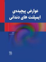 عوارض پیچیده ی ایمپلنت های دندانی