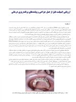 عوارض پیچیده ی ایمپلنت های دندانی - Image 5