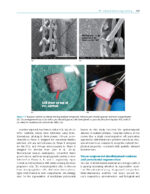 Tissue Engineering and Regeneration in Dentistry: Current Strategies - Image 5