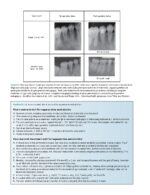 Tissue Engineering and Regeneration in Dentistry: Current Strategies - Image 6