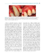 Tissue Engineering and Regeneration in Dentistry: Current Strategies - Image 2