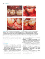 Tissue Engineering and Regeneration in Dentistry: Current Strategies - Image 3