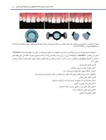 دندانپزشکی ترمیمی دیجیتال (فصول برگزیده) - Image 11