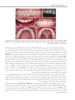 دندانپزشکی ترمیمی دیجیتال (فصول برگزیده) - Image 12