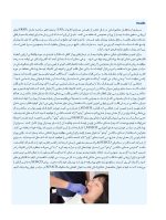 semcd_Page_06 همه می توانند به پروتز کامل فک پایین با ساکشن دست یابند SEMCD - Image 5