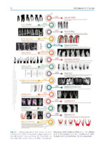 The Root Canal Anatomy in Permanent Dentition 2019 - Image 2