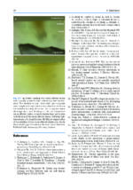 The Root Canal Anatomy in Permanent Dentition 2019 - Image 5