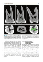 The Root Canal Anatomy in Permanent Dentition 2019 - Image 4