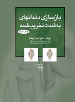 بازسازی دندانهای به شدت تخریب شده (چاپ دوم)