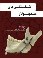 شکستگی های مندیبولار