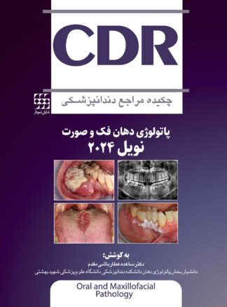 CDR-پاتولوژی-دهان-فک-و-صورت-نویل-2024