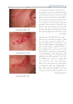 Pages from مبانی_دندانپزشکی_ایمپلنت_زیبایی_نهایی1_Page_08 مبانی دندانپزشکی ایمپلنت زیبایی - Image 8