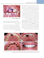 اصول نوین در پروتزهای ثابت دندانی رزنتال 2023 (جلد اول) - Image 9