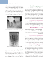 اصول نوین در پروتزهای ثابت دندانی رزنتال 2023 (جلد اول) - Image 10
