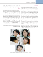 اصول نوین در پروتزهای ثابت دندانی رزنتال 2023 (جلد اول) - Image 12