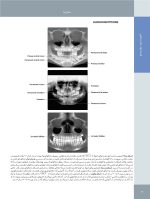 تصویربرداری تشخیصی از دهان، فک و صورت_Page_12 تصویربرداری تشخیصی از دهان، فک و صورت - Image 11