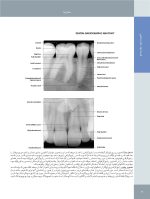 تصویربرداری تشخیصی از دهان، فک و صورت_Page_14 تصویربرداری تشخیصی از دهان، فک و صورت - Image 13