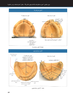 ساکشن فک پایین_Page_28 ساکشن پروتز کامل فک پایین به صورت "پیشرفته" - Image 11