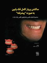 ساکشن پروتز کامل فک پایین به صورت "پیشرفته"