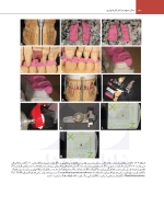 اصول نوین در پروتزهای دندانی رزنتال 2023 (جلد دوم) - Image 3